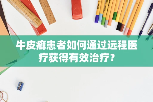 牛皮癣患者如何通过远程医疗获得有效治疗？