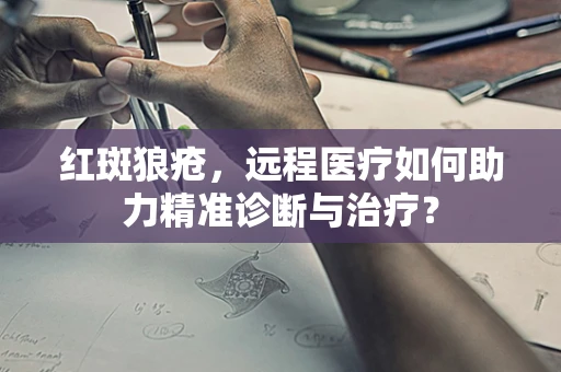 红斑狼疮，远程医疗如何助力精准诊断与治疗？